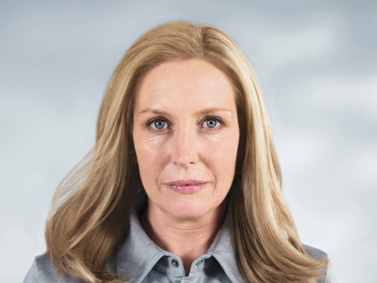 Prije sculptra tretmana