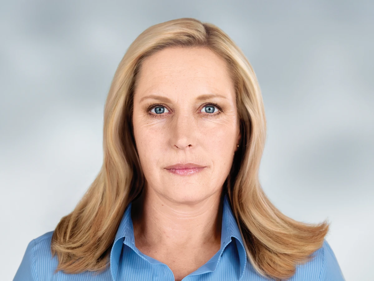 nakon sculptra tretmana