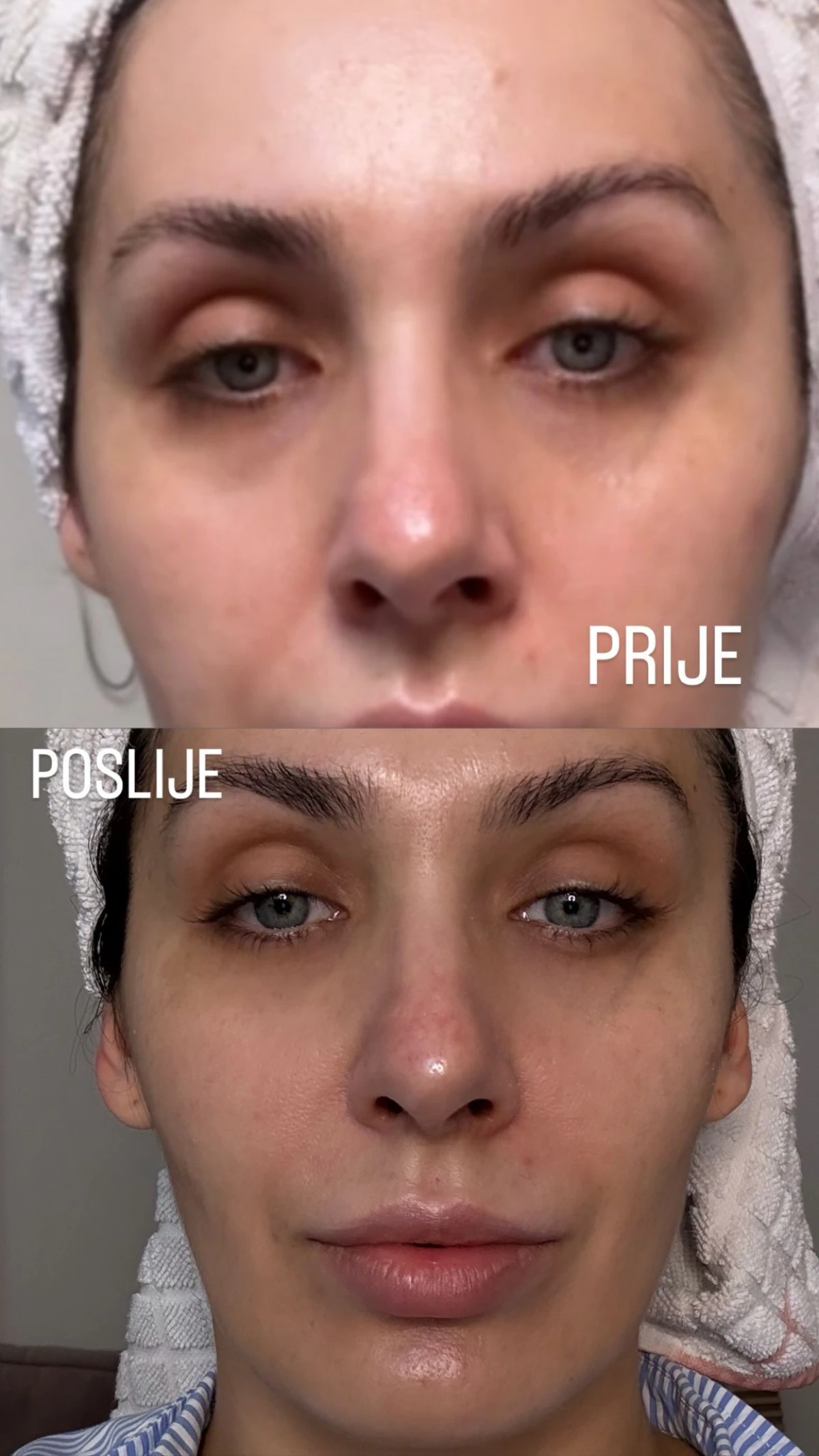 Tajna ljetnog no makeup izgleda krije se u ovom jedinstvenom proizvodu