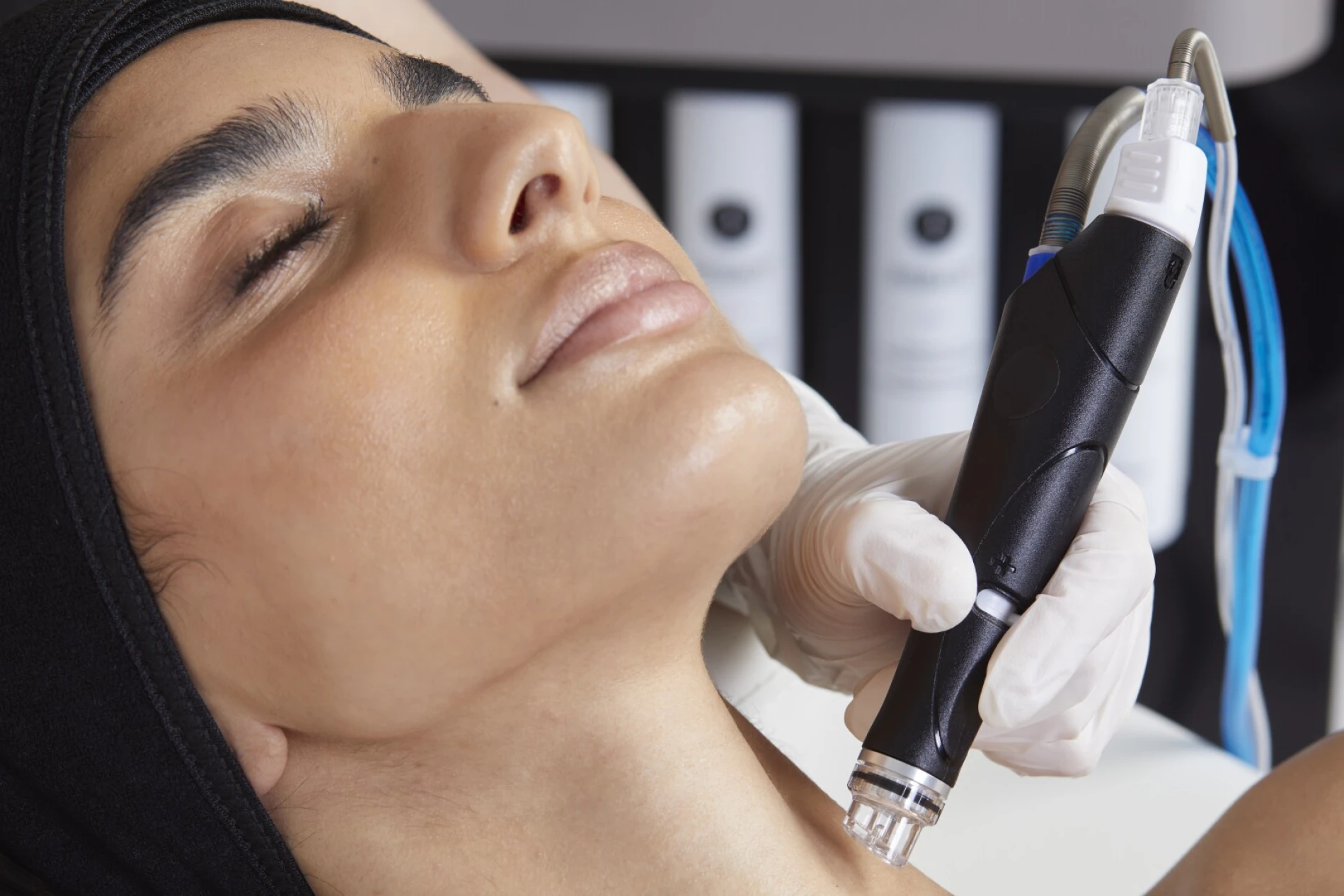Hydrafacial x Circadia: Ljetni tretman koji koži vraća vlagu, sjaj i elastičnost