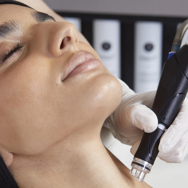 Hydrafacial x Circadia: Ljetni tretman koji koži vraća vlagu, sjaj i elastičnost