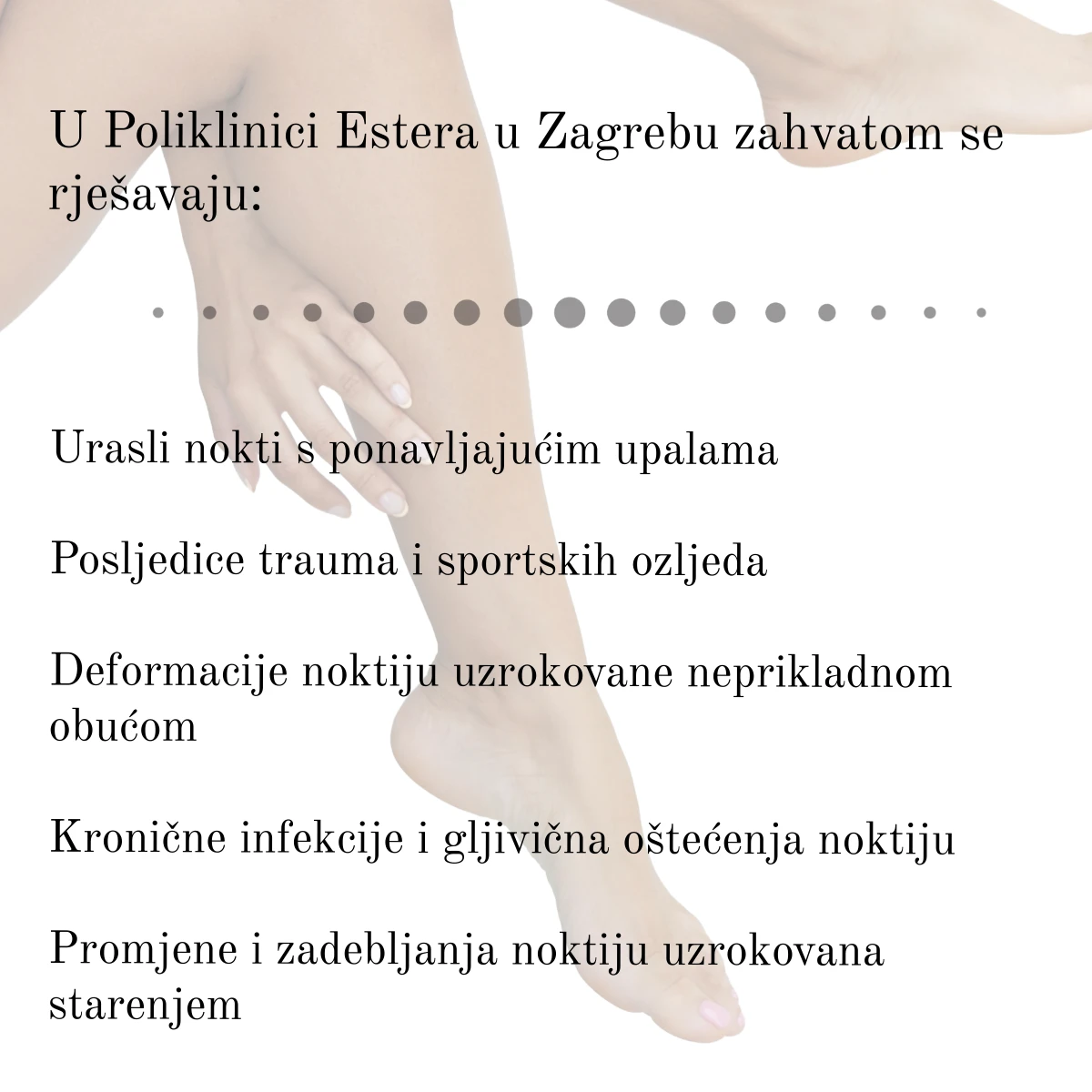Kirurgija nokta u Zagrebu: Pronašli smo stručno rješenje za sve probleme s notkima