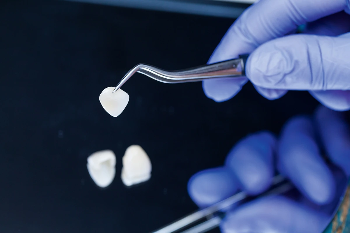 Digitalna preciznost, prirodan rezultat: Dr. Filip Štimac o novoj eri osmijeha